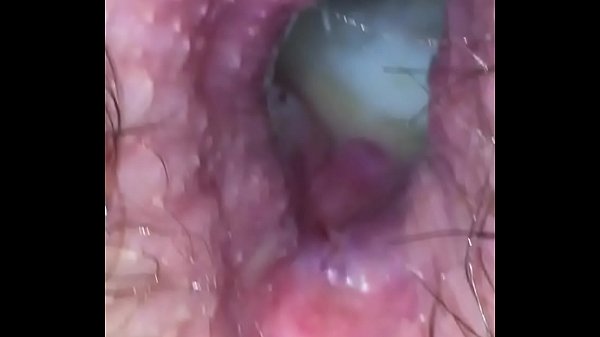 Travesti tirou Camisinha e gozou dentro do novinho