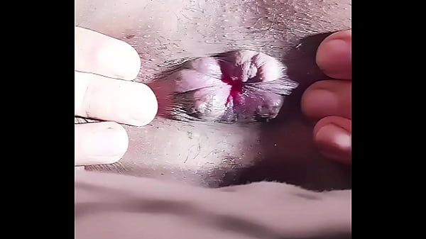 Sissy Candy Rose – Transgirl Swollen Prolapse Asshole is Thirsty for Cocks